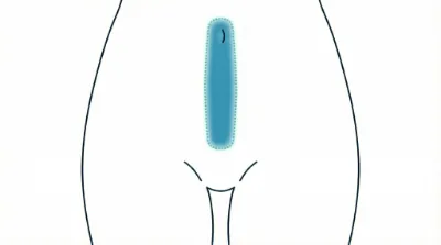 Diagram for Linea alba