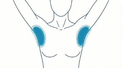 Diagram for Underarms
