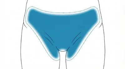 Diagram for Classic bikini