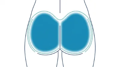 Diagram for Buttocks