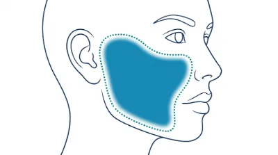 Diagram for Cheeks