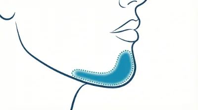 Diagram for Chin