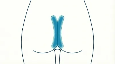Diagram for Intergluteal area